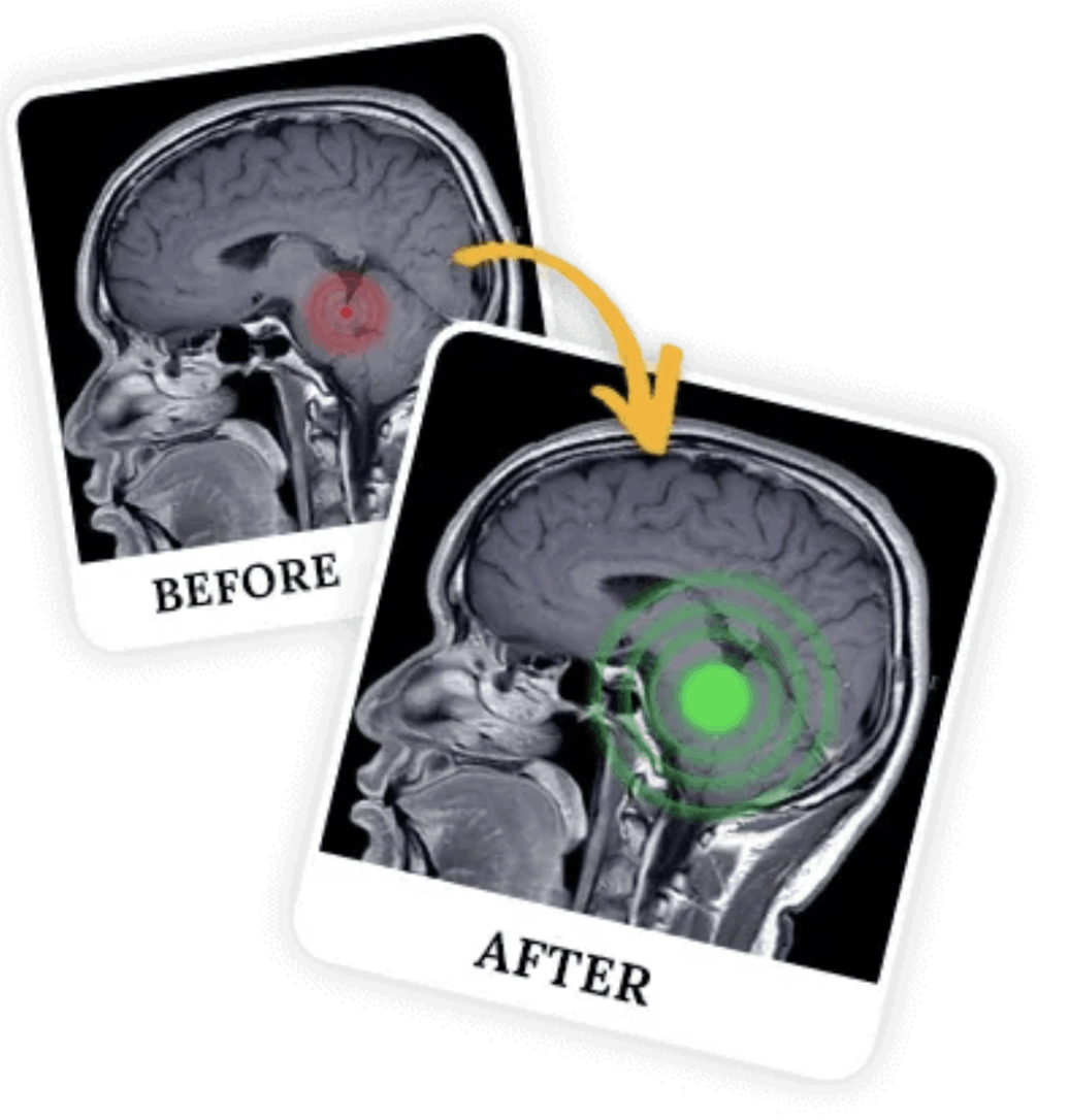 the-brain-song-programs